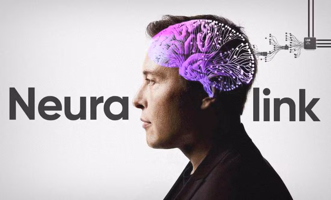 Neuralink realiza su segundo implante cerebral exitoso en humanos